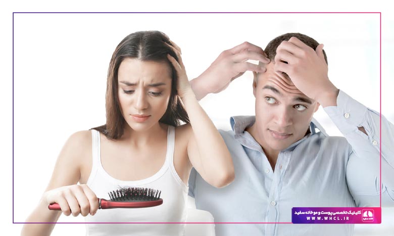 جلوگیری از ریزش مو
